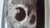 IMG-20170823-WA0019.jpeg