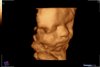 05111984_wiecherinkbaby_201708280007.jpg