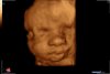 05111984_wiecherinkbaby_201708280016.jpg
