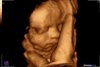 05111984_wiecherinkbaby_201708280004.jpg