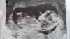 IMG-20170821-WA0001.jpeg