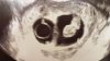 IMG-20170905-WA0008.jpeg
