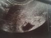 Baby Kroon.jpg