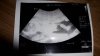 IMG-20170914-WA0000.jpeg