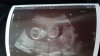 IMG-20170920-WA0000.jpeg