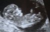 2017-10-05 00.19.52.jpg