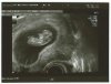 3e echo 10wkn (1).jpg