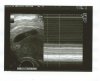 1e echo - 7wkn (4).jpg