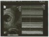 2e echo 8wkn (4).jpg