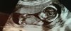 IMG-20171018-WA0007.jpeg