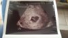 IMG-20171019-WA0003.jpeg