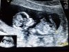 20171022_215947.jpg