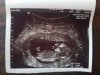 IMG-20171026-WA0000.jpg