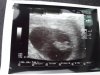 20171026_120950.jpg