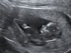 IMG_20171019_8.jpg