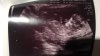 13335147-2173-4269-A085-491AF57DC035.jpeg
