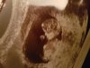 20171010_164357.jpg