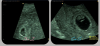 20171103_201455.png