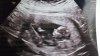 IMG-20171019-WA0022.jpeg