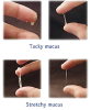 cervicalmucus.png