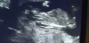 20171112_180418.png