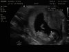 IMG-20171115-WA0000.jpg