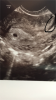 4AE5D3DD-8354-4381-B625-0EF5390C6ED1.png