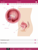 BC6A2951-D465-4A6F-93D9-5F97A793B4EB.png