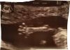20171121_193110.png