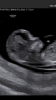 BB1999F7-3096-45E0-A87D-423B778F3A92.png