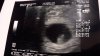 IMG-20171123-WA0000.jpeg