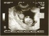 Baby 10w4d.jpg