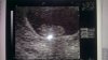 baby 26-07-2012.jpg
