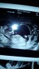 IMG-20171126-WA0009.jpg