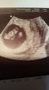 IMG-20171129-WA0000.jpeg