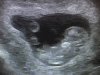 6576AC1C-F2B6-4B12-AEE4-B68D28A2029B.jpeg