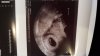 IMG-20171130-WA0007.jpeg