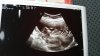 IMG-20171208-WA0012.jpeg