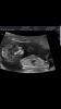 Screenshot_20171210-164536.png