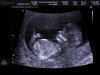 foto (1).jpg