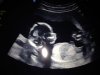 IMG-20171218-WA0004.jpg