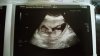 IMG-20171219-WA0002.jpeg