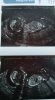 IMG-20180103-WA0001.jpeg