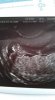 IMG-20180103-WA0004.jpeg