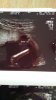 IMG-20180108-WA0005.jpeg