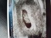 20180111_093554.jpg