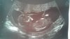 20180117_122206.jpg