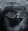 20180119_193309.jpg