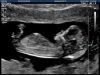 35131320180125_CAITLIN_20180125134156135.jpg