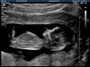 35131320180125_CAITLIN_20180125134013588.jpg
